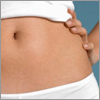 Szépségvarázs - Striák, Terhességi csíkok kezelése bőrcsiszolással